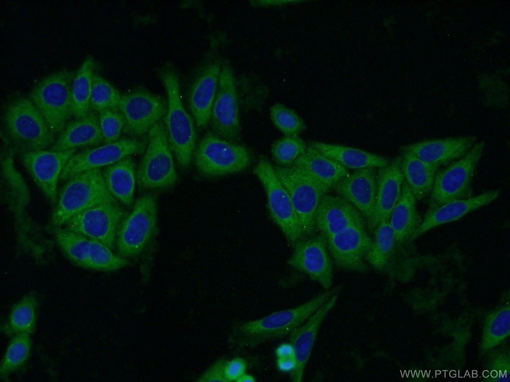 QPRT Polyclonal antibody