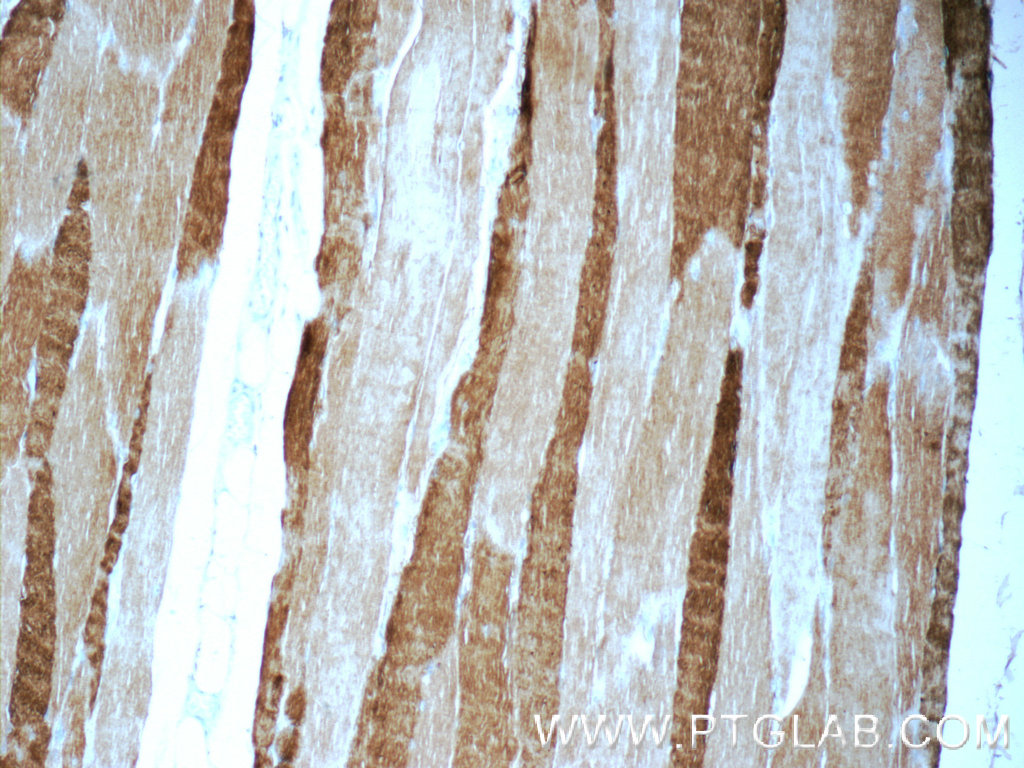 MYH1 (N-terminal) Polyclonal antibody