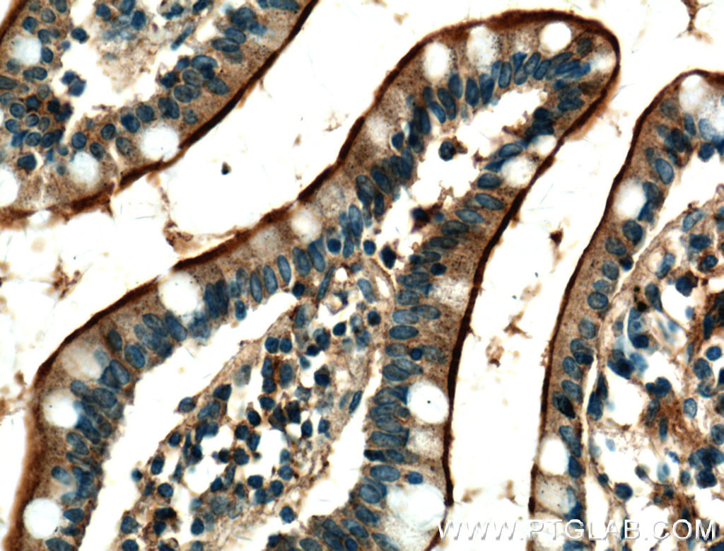 USE1 Polyclonal antibody