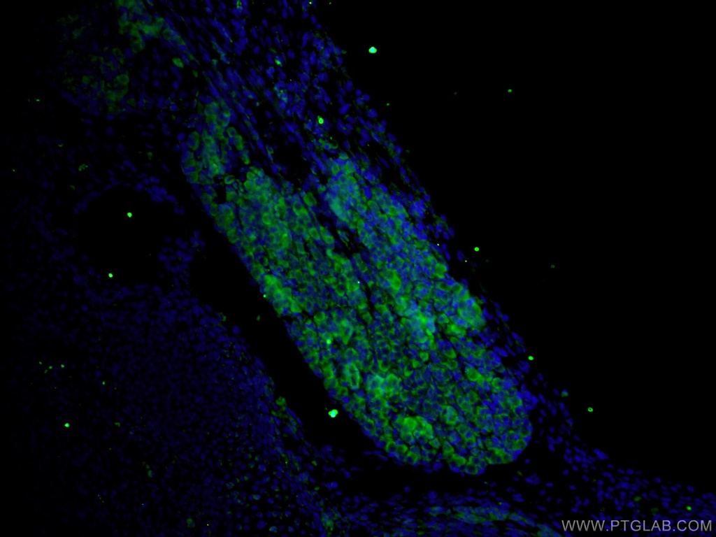 DTX4 Polyclonal antibody