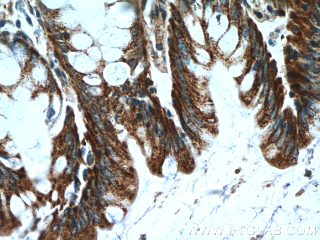 KLHL28 Polyclonal antibody