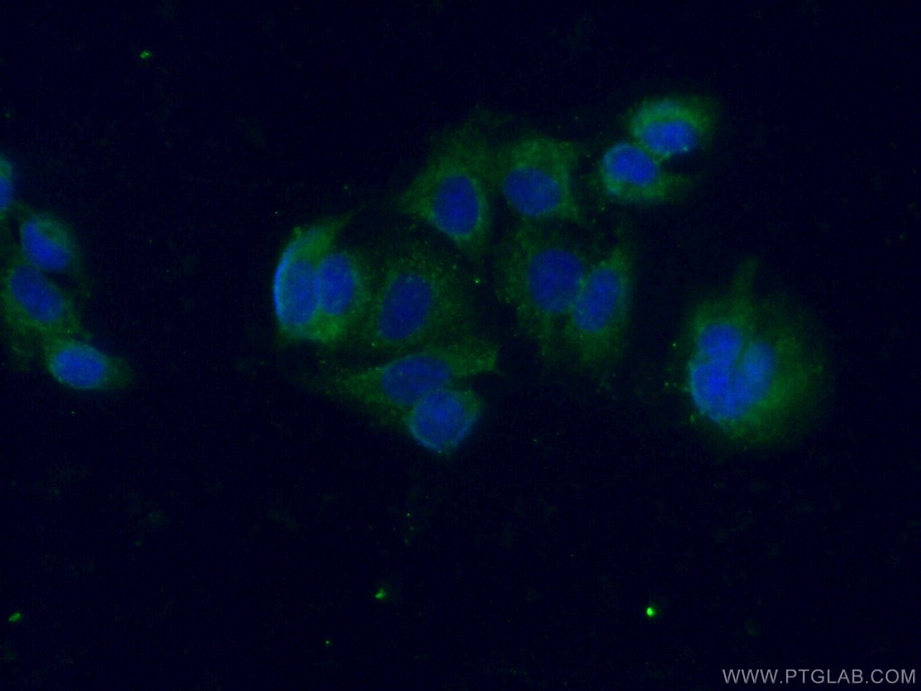 Galectin 10 Polyclonal antibody