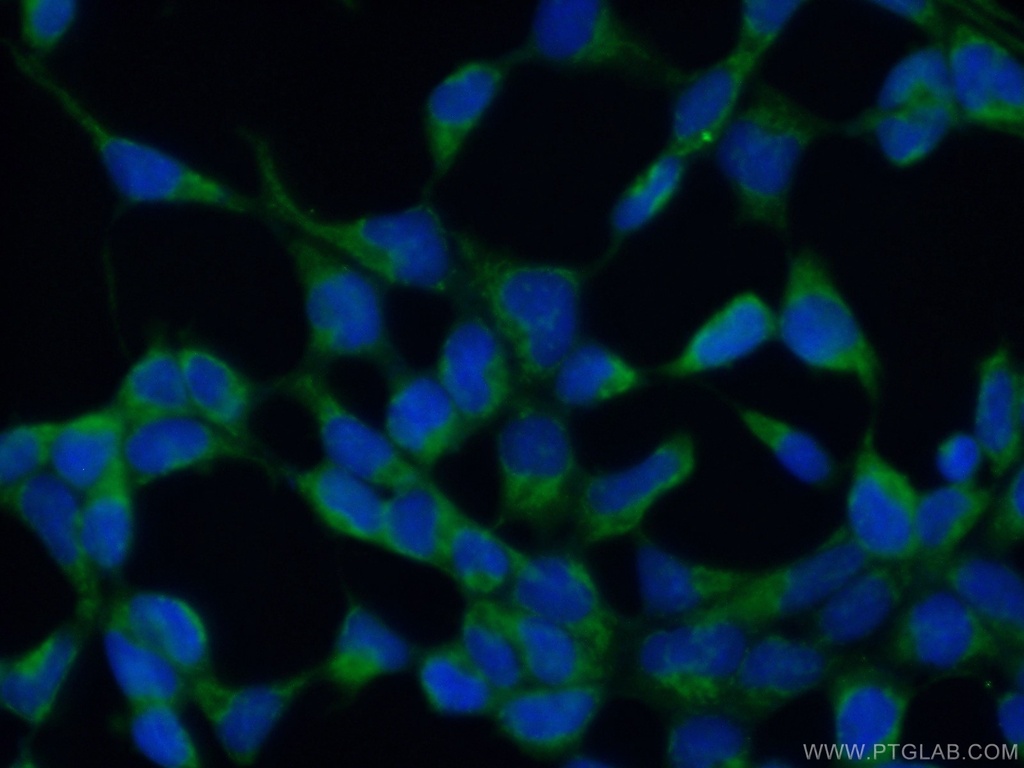 MARF1 Polyclonal antibody
