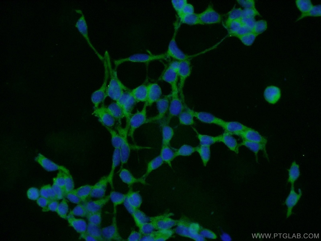COMMD8 Polyclonal antibody