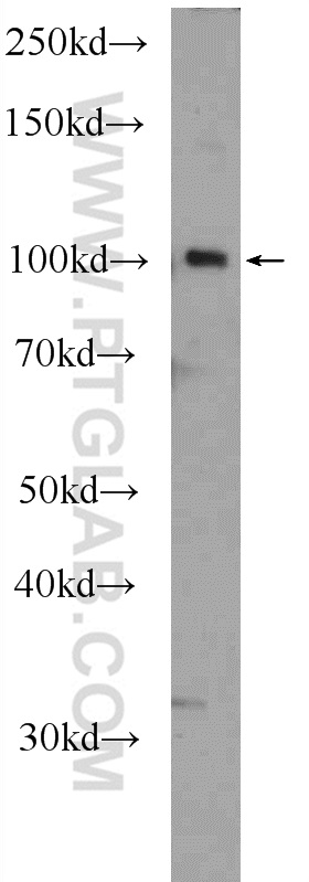 SFMBT2 Polyclonal antibody
