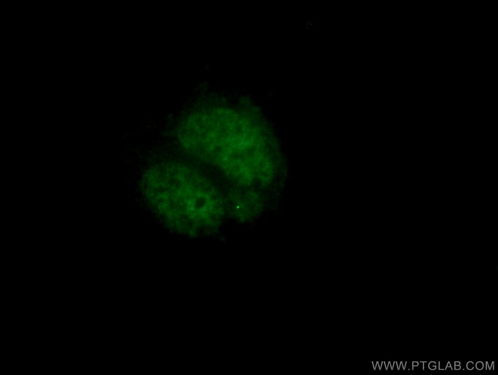PHOX2B Polyclonal antibody