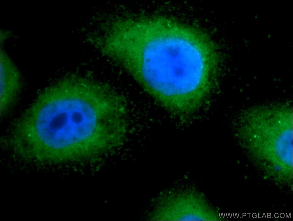 TRAPPC2L Polyclonal antibody