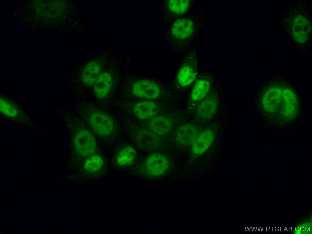 CWC15 Polyclonal antibody