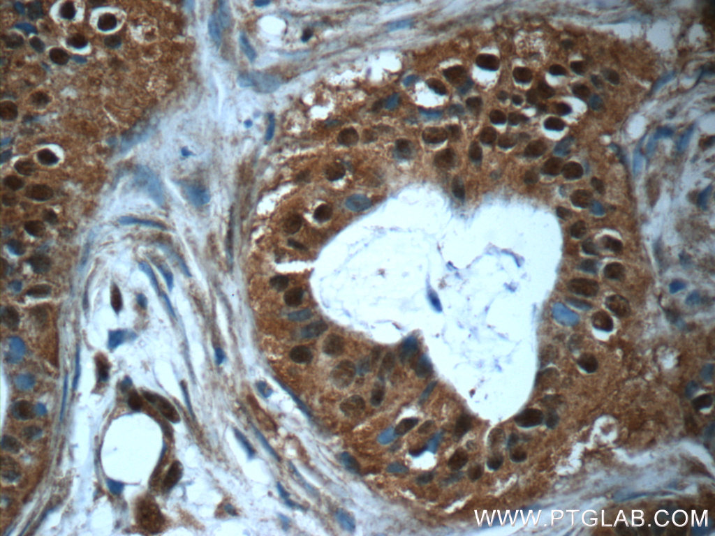 RBM25 Polyclonal antibody