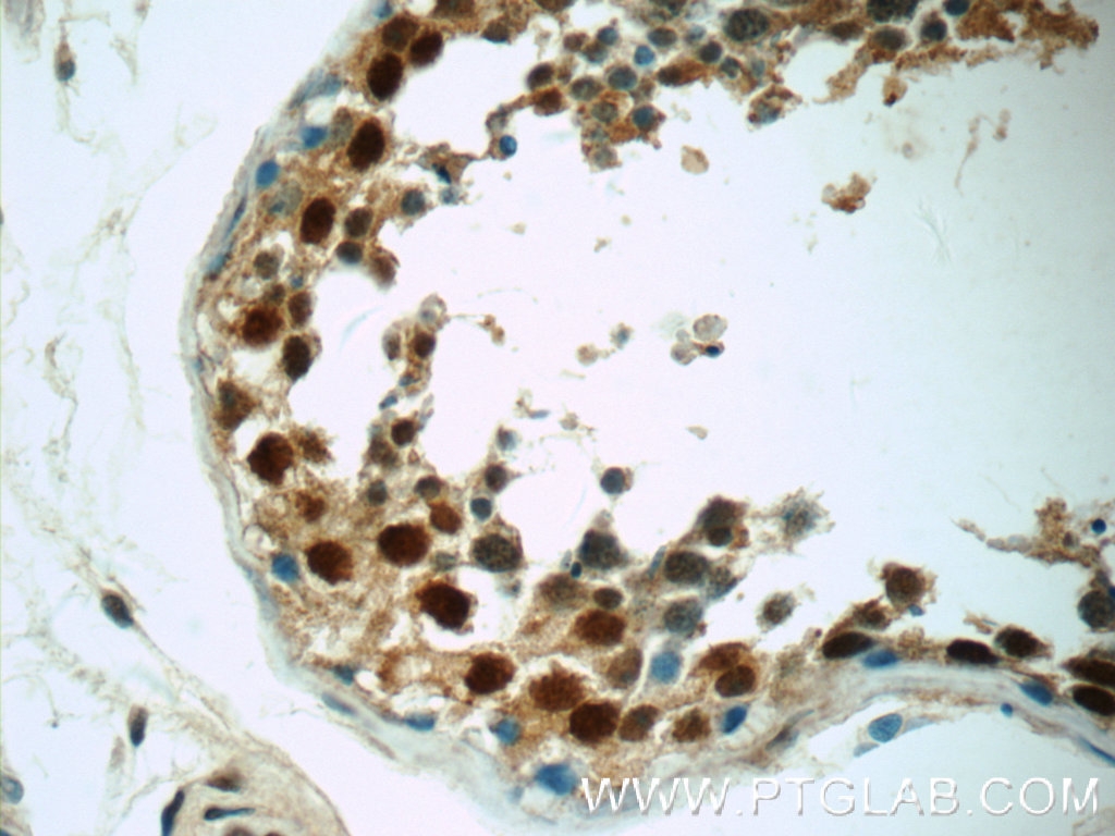 ZNF571 Polyclonal antibody