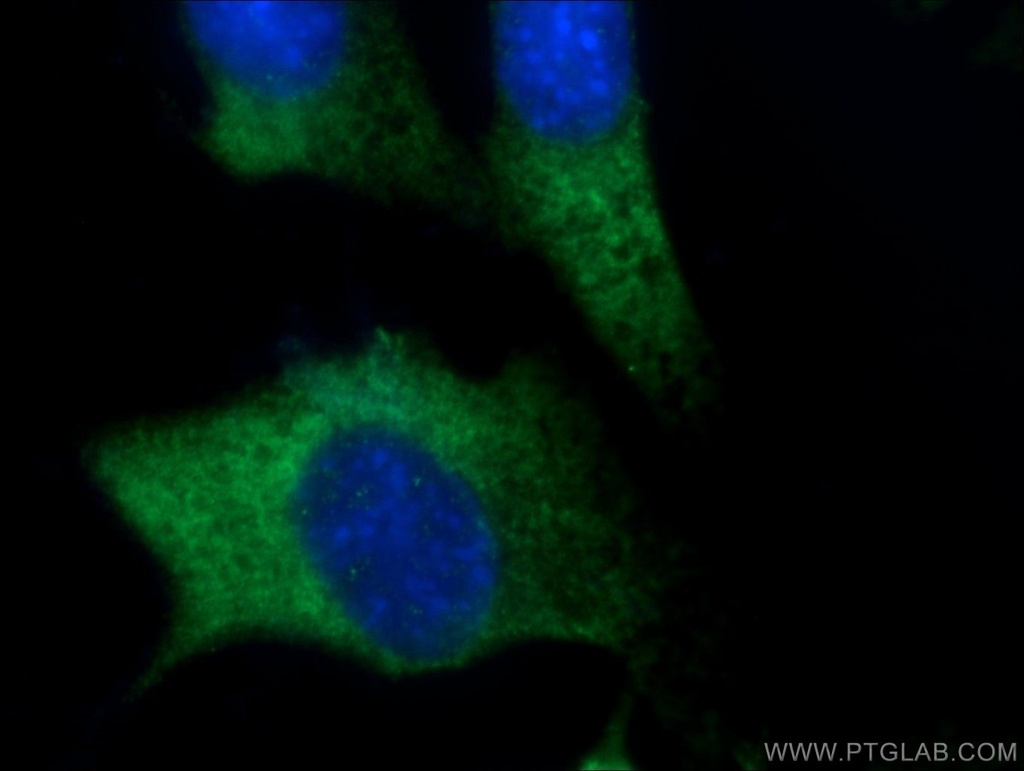 FGF17 Polyclonal antibody