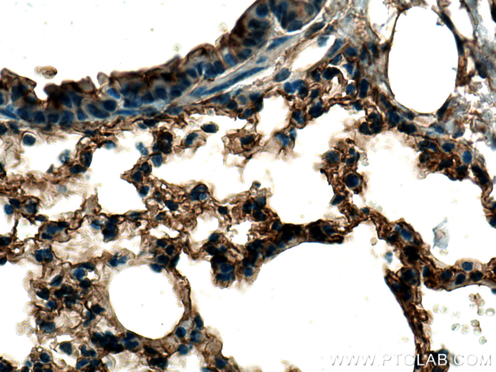 EHD3 Polyclonal antibody