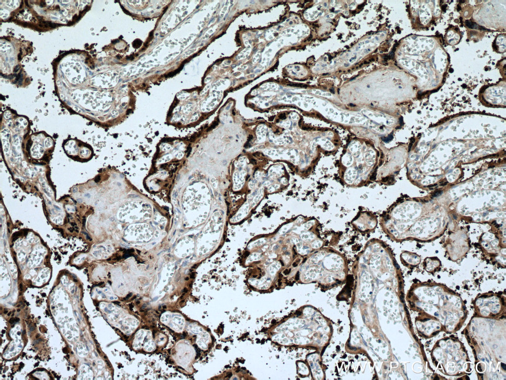 HSD17B1 Polyclonal antibody