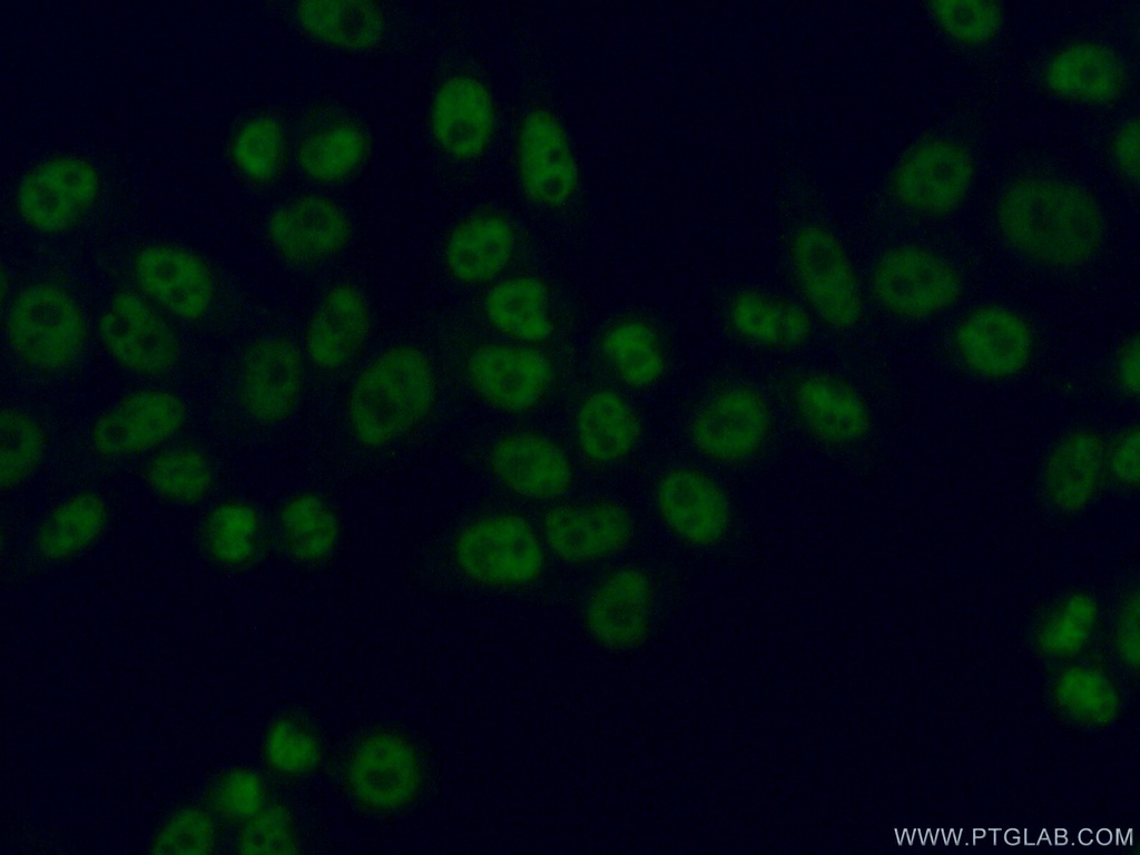 SBNO1 Polyclonal antibody