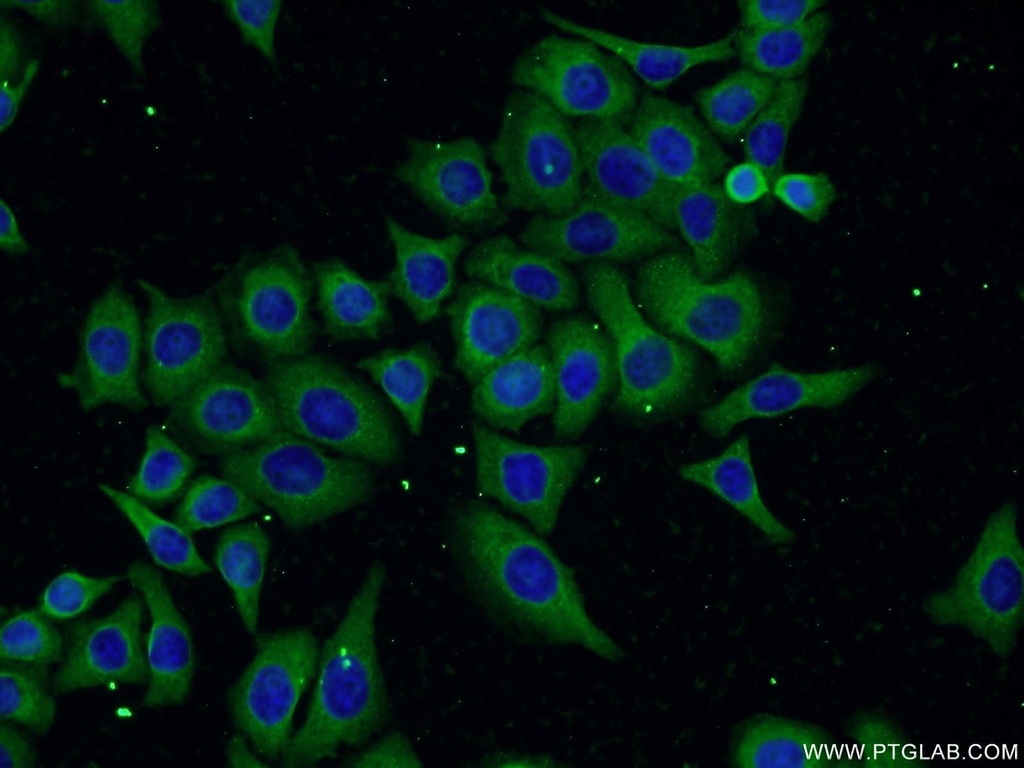FAM160B1 Polyclonal antibody