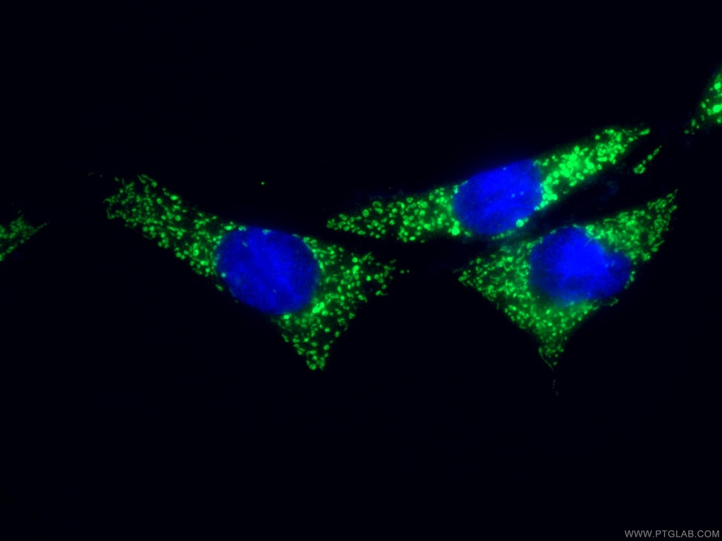 SLC25A22 Polyclonal antibody