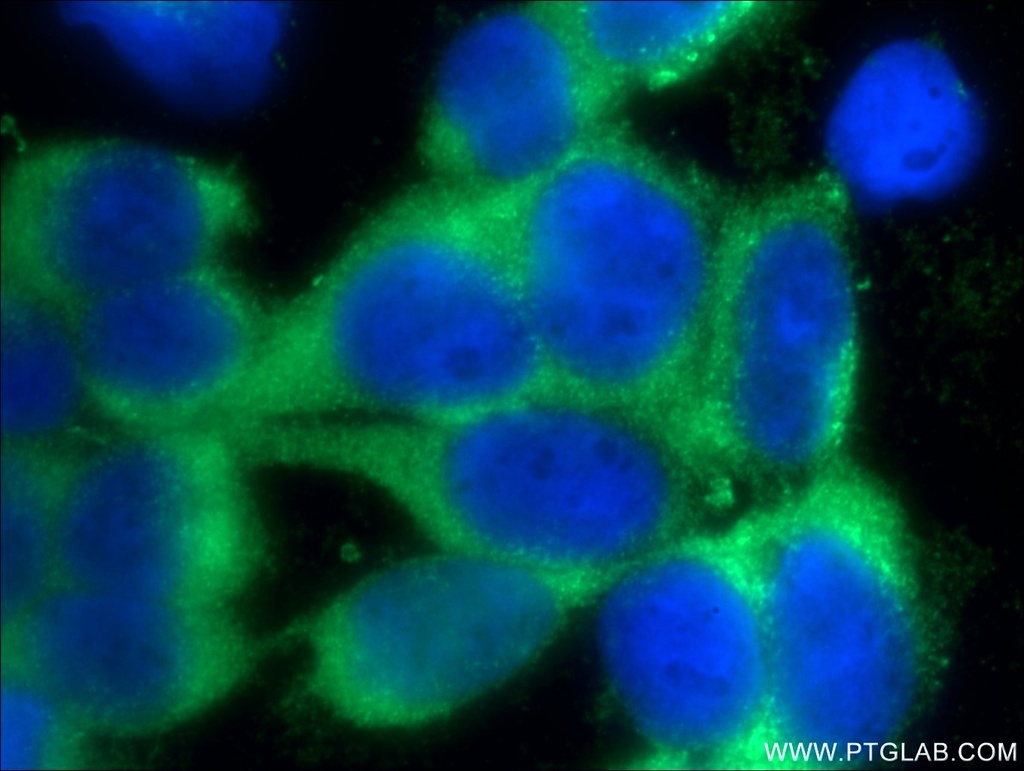 TTC32 Polyclonal antibody