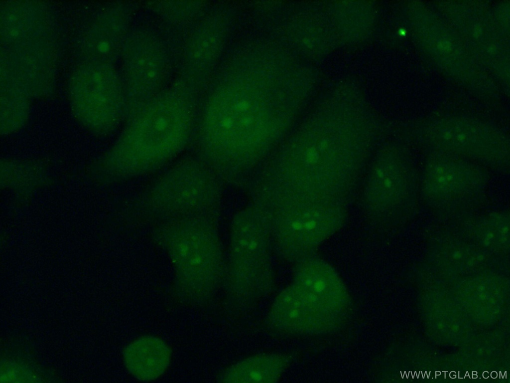 RRP36 Polyclonal antibody