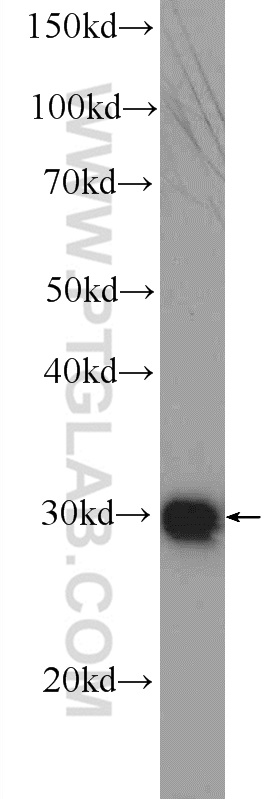 DNAJC9 Polyclonal antibody