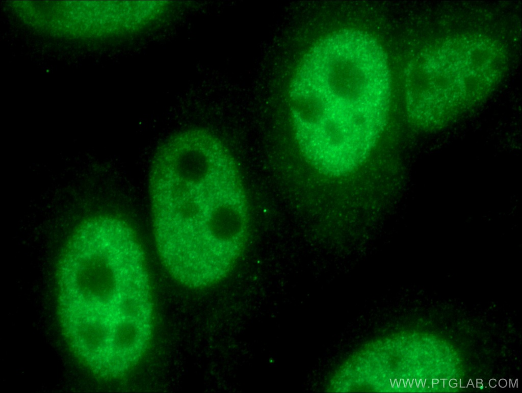 TWIST1-specific Polyclonal antibody