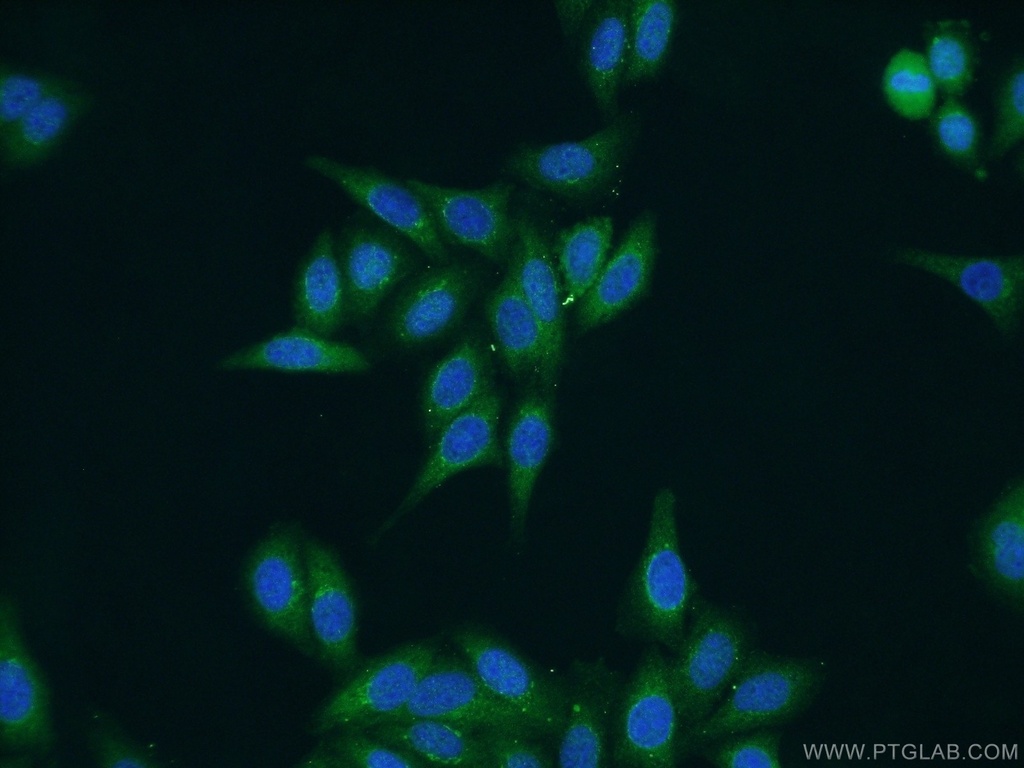 SAAL1 Polyclonal antibody