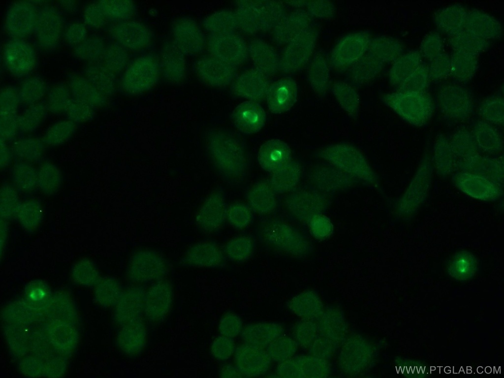 CKAP2 Polyclonal antibody
