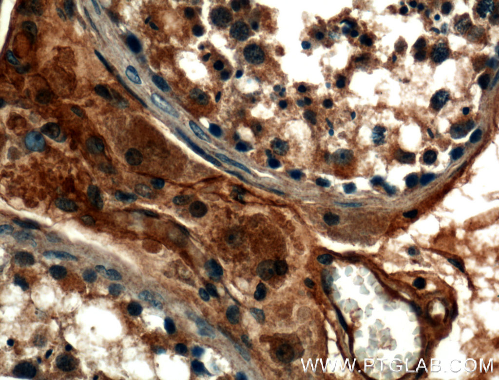 TMEM102 Polyclonal antibody