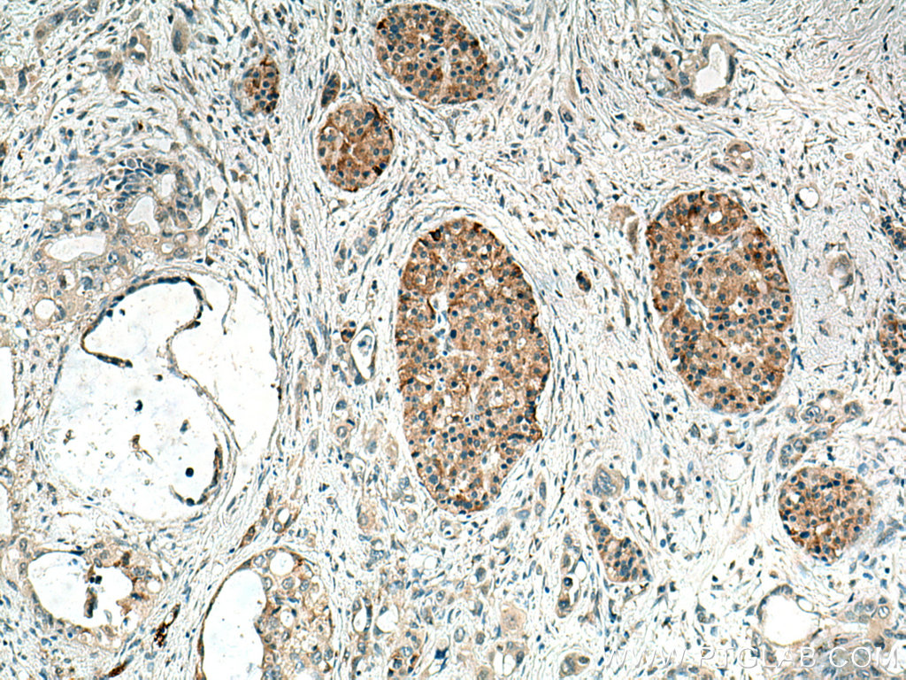 TMEM24 Polyclonal antibody