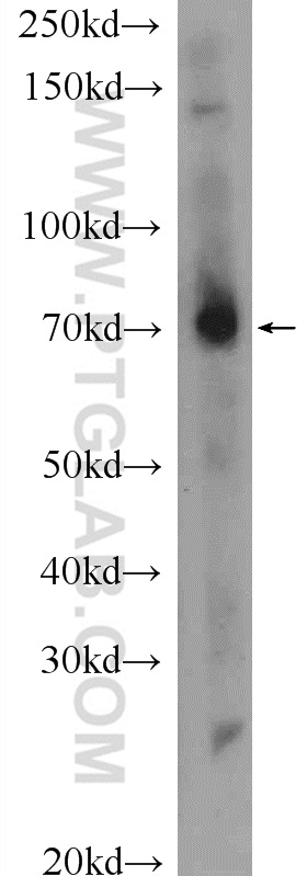 MPZL3 Polyclonal antibody
