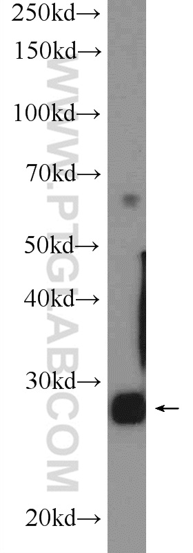 PGAM2 Polyclonal antibody