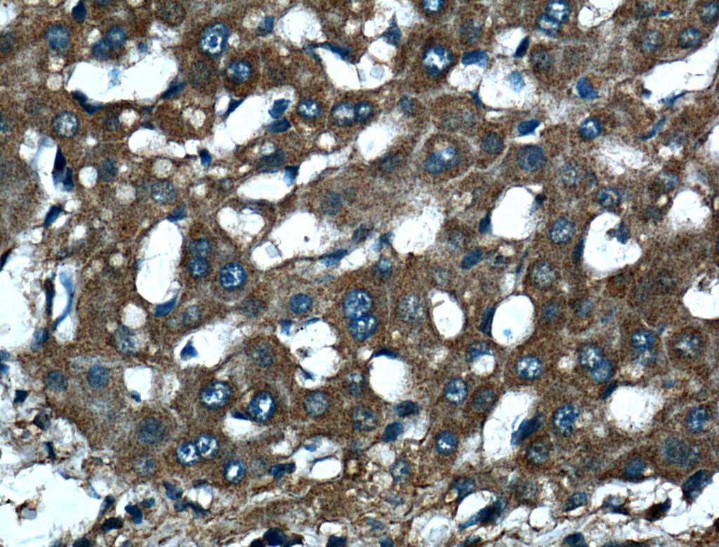 DLL3 Polyclonal antibody