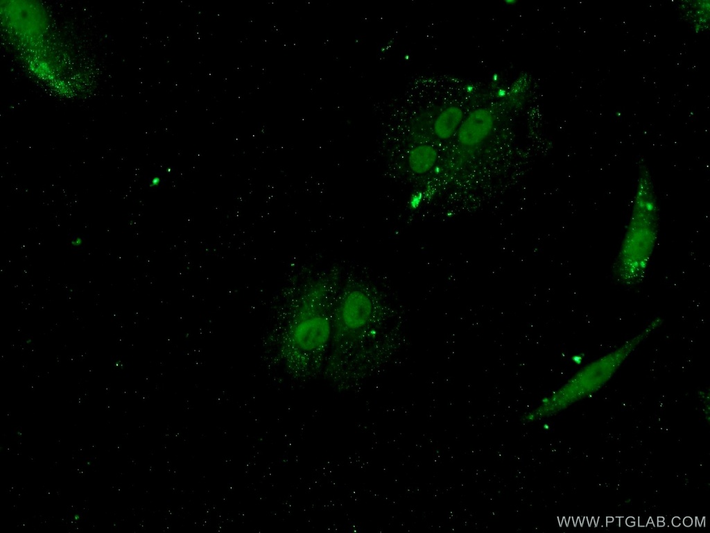 YTHDF3-specific Polyclonal antibody