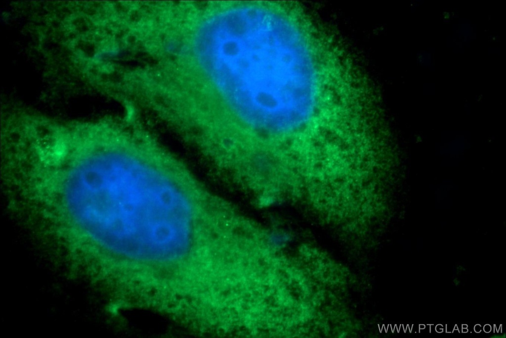 PGBD1 Polyclonal antibody