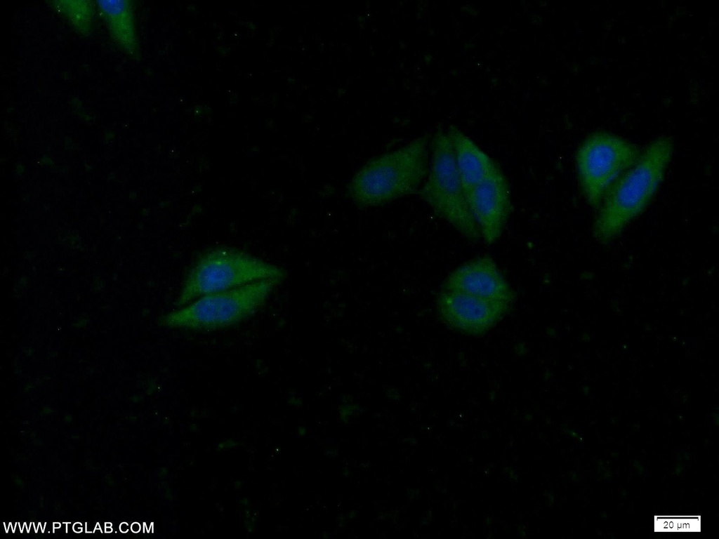 WDR92 Polyclonal antibody