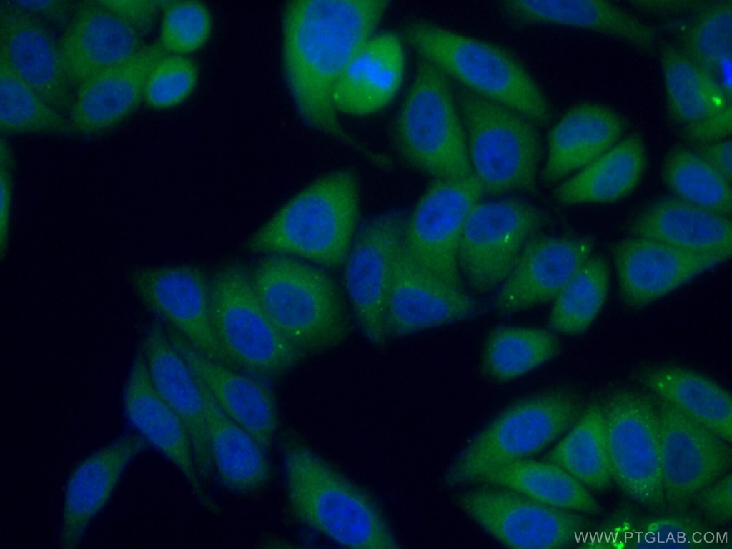 C2orf79/PTRHD1 Polyclonal antibody