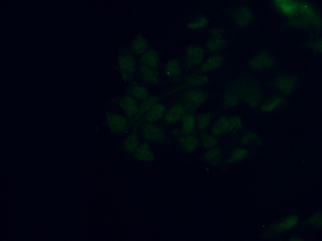 SMCHD1 Polyclonal antibody