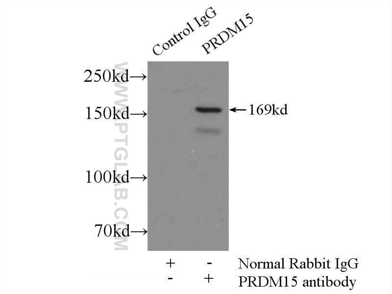 PRDM15 Polyclonal antibody