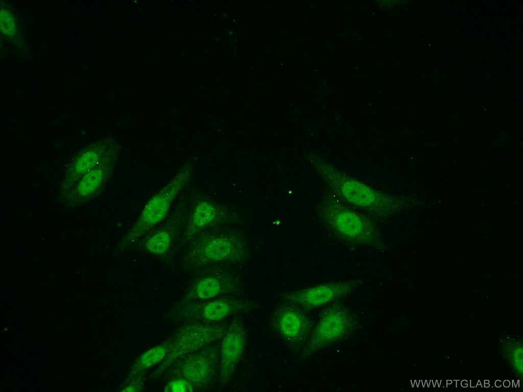 ZNF101 Polyclonal antibody