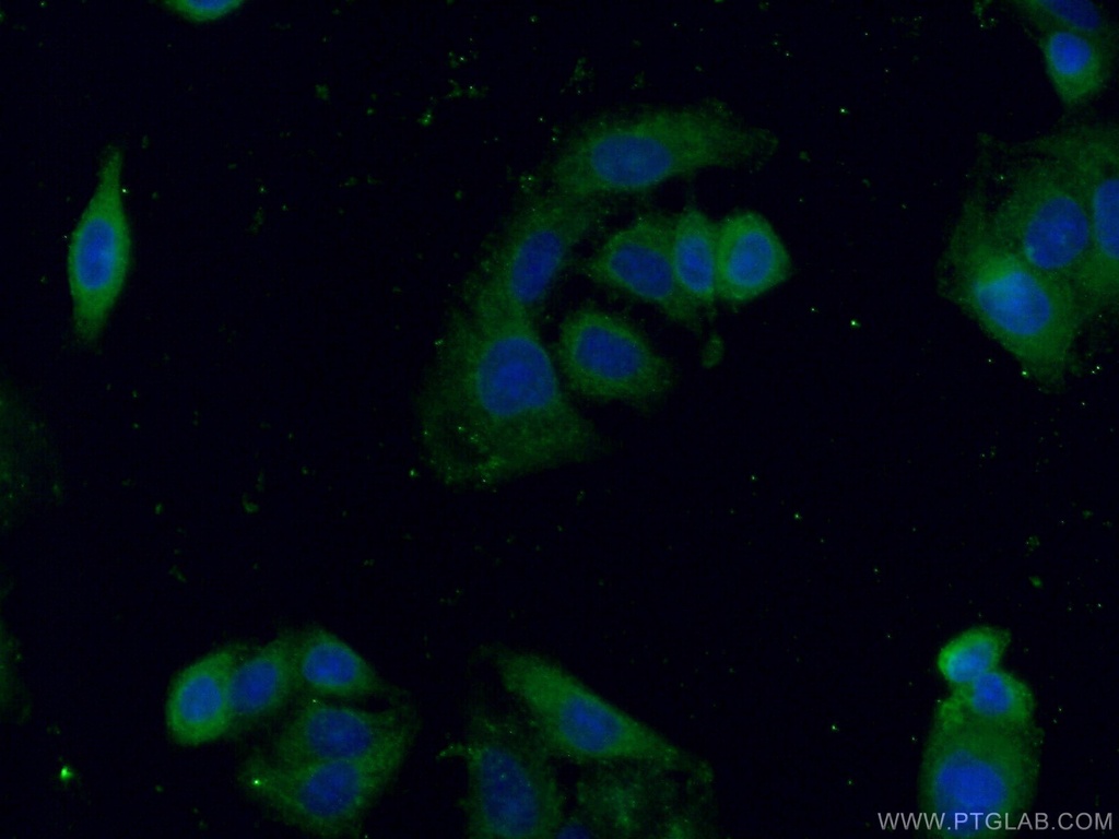 EPHX3 Polyclonal antibody