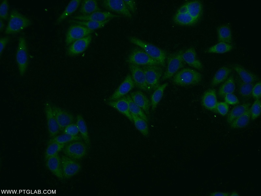 ASB13 Polyclonal antibody