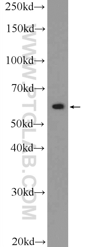 ZBTB22 Polyclonal antibody