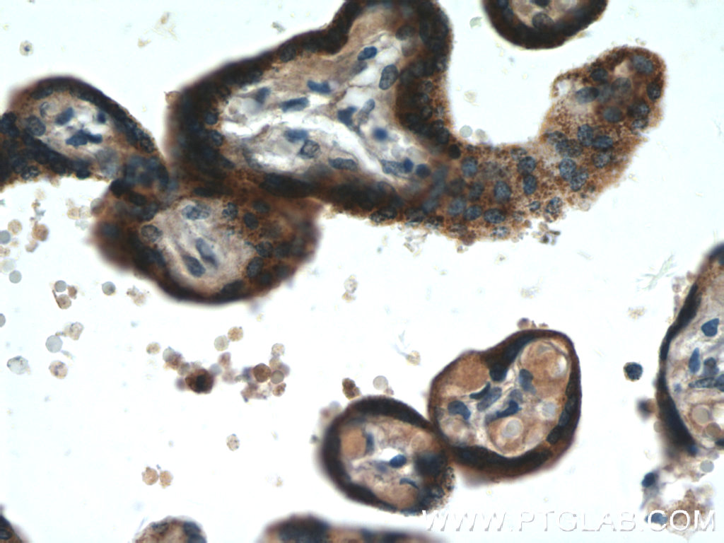 C11orf83 Polyclonal antibody