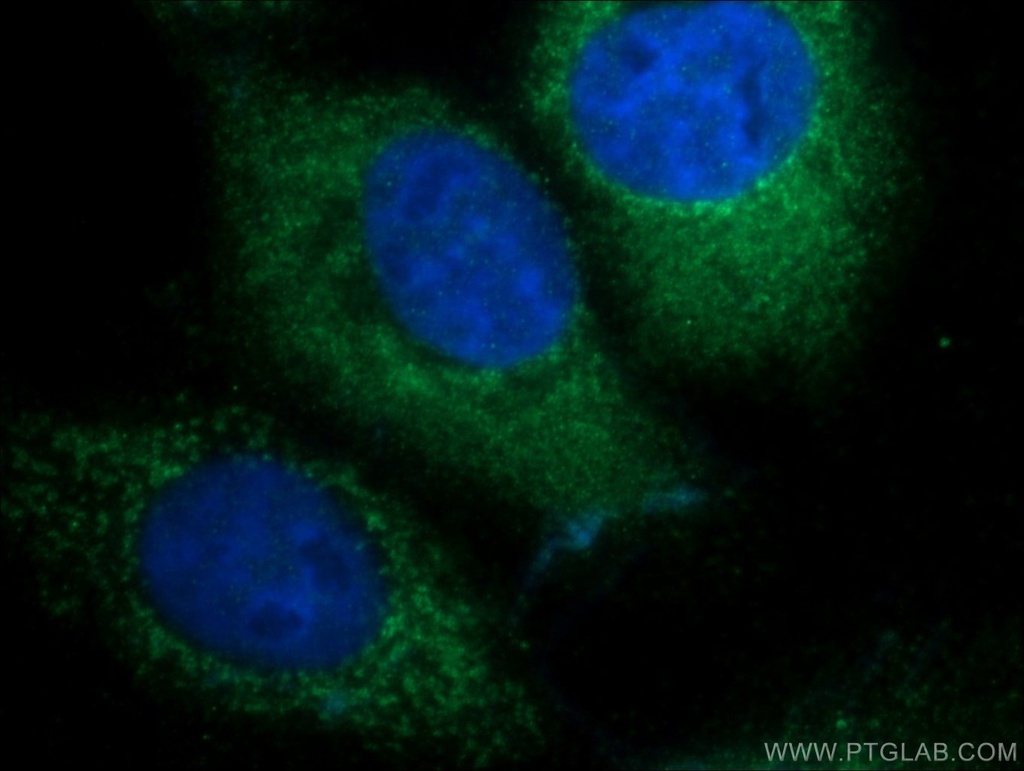 DENND1A Polyclonal antibody