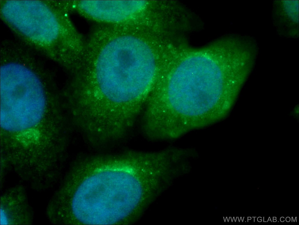 GGA1 Polyclonal antibody