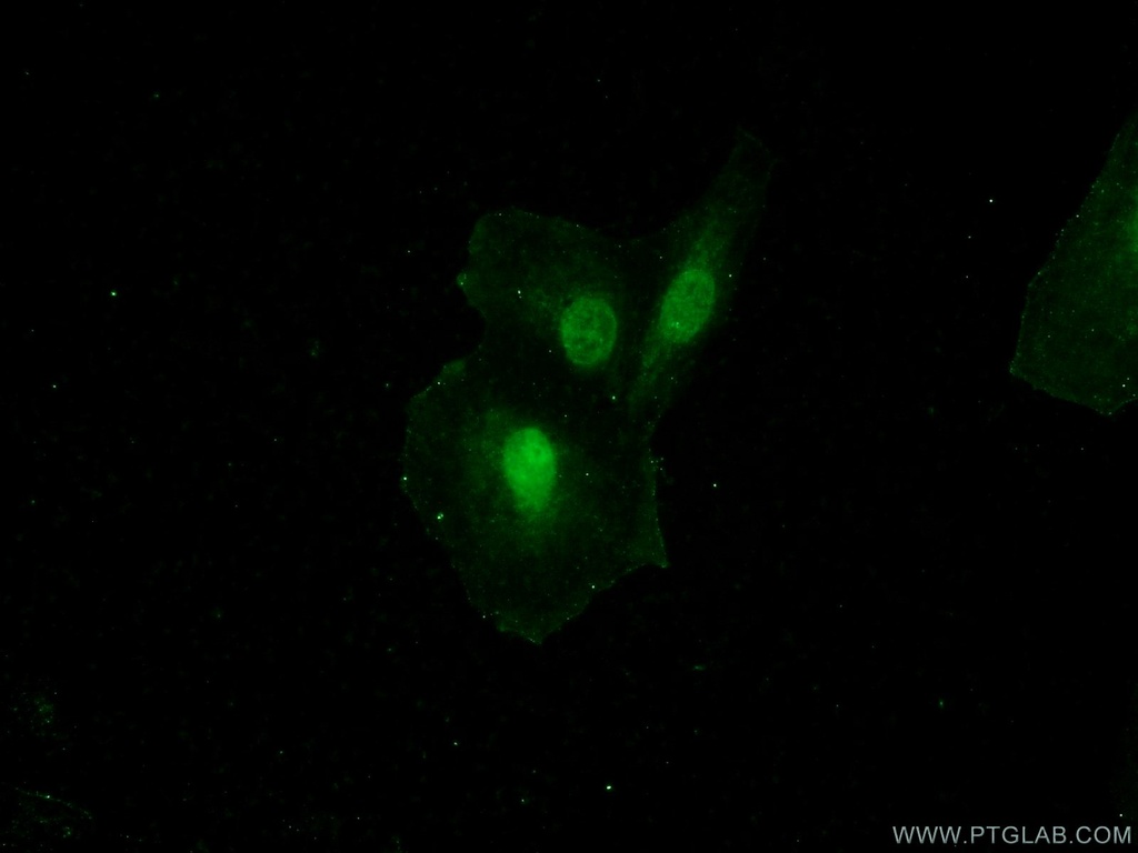 GATAD2B Polyclonal antibody