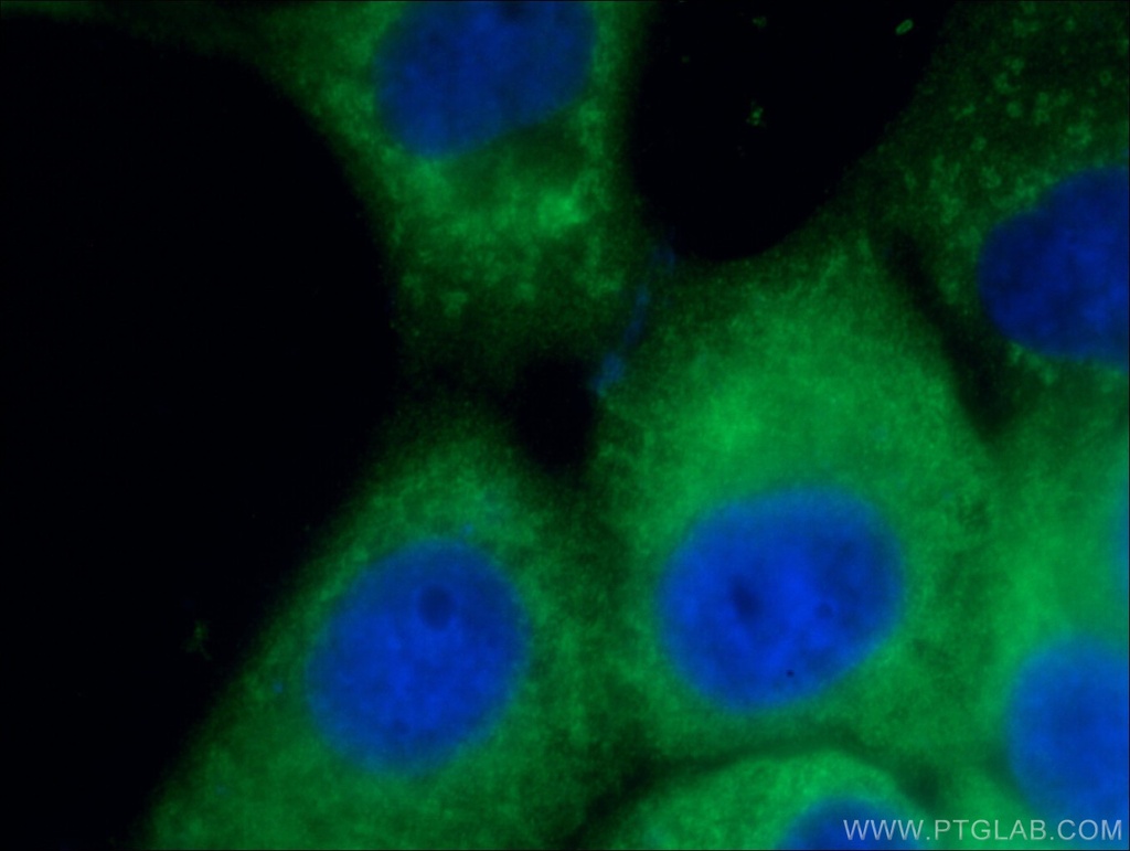 CD63 Polyclonal antibody