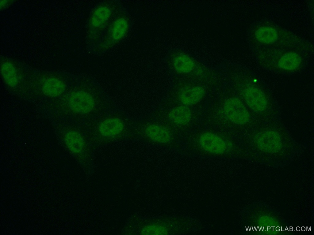 API5 Polyclonal antibody