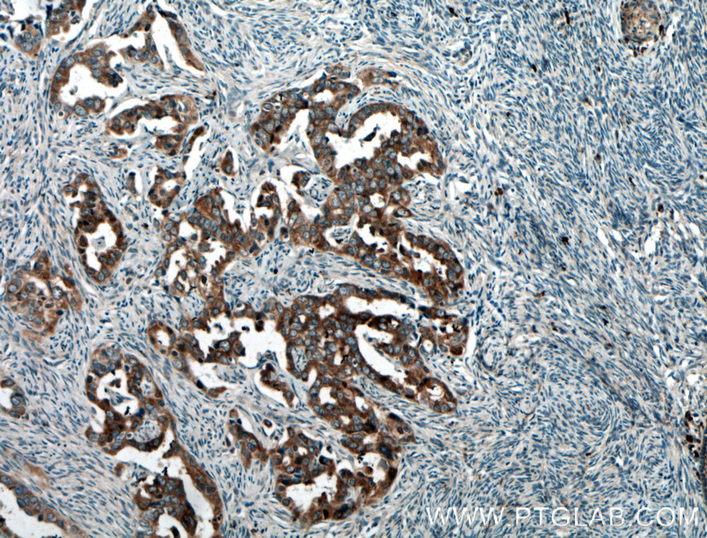 BAIAP2L1 Polyclonal antibody
