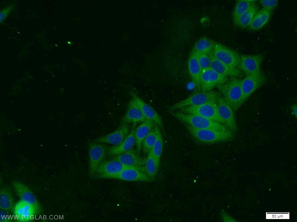 TACC3 Polyclonal antibody