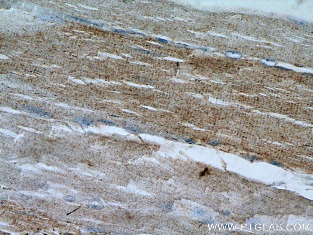 LPPR2 Polyclonal antibody